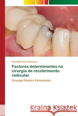 Fatores determinantes no resultado dos procedimentos cirúrgicos de recobrimento radicular Menezes Gonçalves, Nuno 9786139632503 Novas Edicioes Academicas - książka