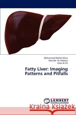 Fatty Liver: Imaging Patterns and Pitfalls Mohsin Khan Mohammad, Ali Siddiqui Mustafa, Ali Ch Zafar 9783659319228 LAP Lambert Academic Publishing - książka