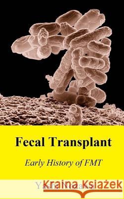 Fecal Transplant: Early History of FMT Nozawa, Yashi 9781507834633 Createspace - książka