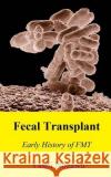 Fecal Transplant: Early History of FMT Nozawa, Yashi 9781507834633 Createspace