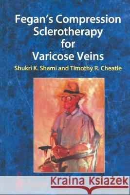 Fegan's Compression Sclerotherapy for Varicose Veins Shukri K. Shami Timothy R. Cheatle 9781447134756 Springer - książka