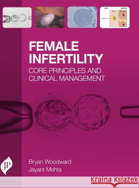 Female Infertility Woodward, Bryan 9781909836501 Jp Medical Ltd - książka