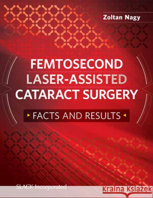 Femtosecond Laser-Assisted Cataract Surgery: Facts and Results Zoltan Z. Nagy 9781617119965 Slack - książka
