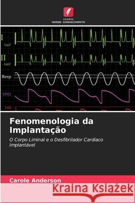 Fenomenologia da Implantação Anderson, Carole 9786208477257 Edições Nosso Conhecimento - książka