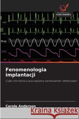 Fenomenologia implantacji Anderson, Carole 9786208474690 Wydawnictwo Nasza Wiedza - książka