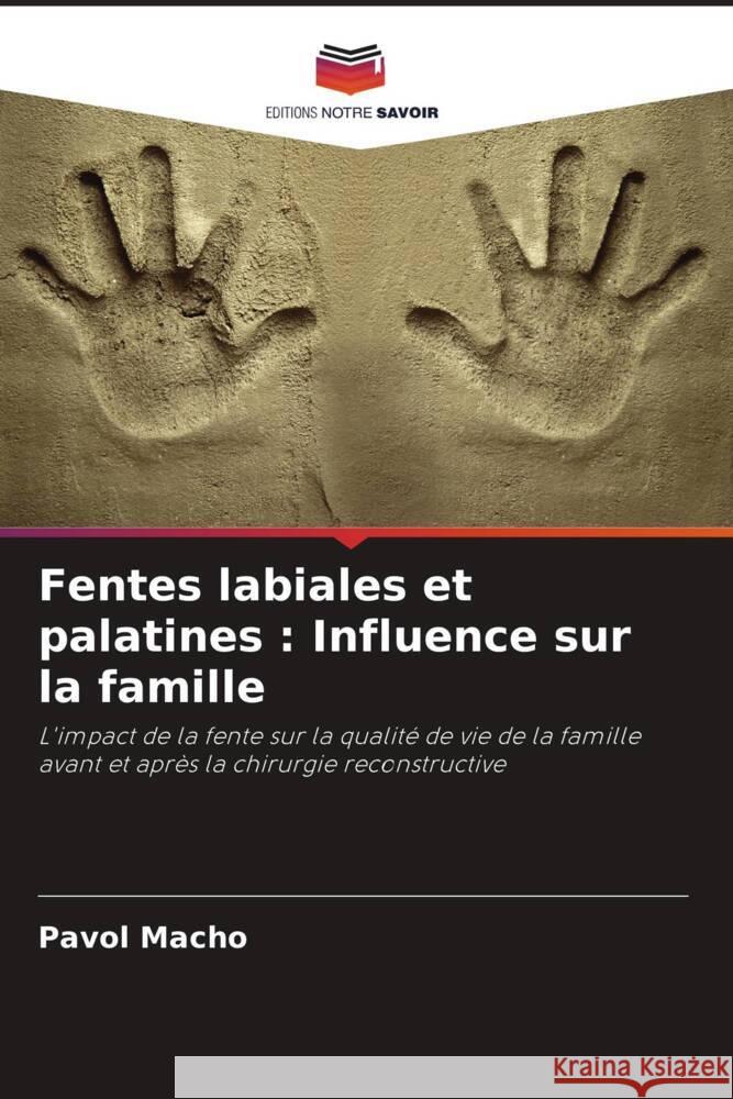 Fentes labiales et palatines : Influence sur la famille Macho, Pavol 9786208089900 Editions Notre Savoir - książka