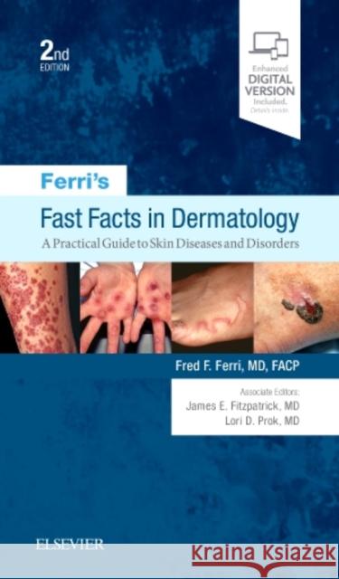 Ferri's Fast Facts in Dermatology: A Practical Guide to Skin Diseases and Disorders Fred F. Ferri   9780323530392 Elsevier - Health Sciences Division - książka