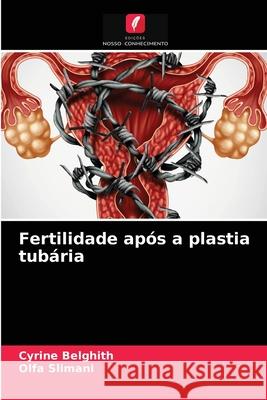 Fertilidade após a plastia tubária Cyrine Belghith, Olfa Slimani 9786204040851 Edicoes Nosso Conhecimento - książka