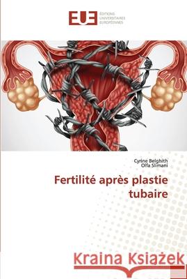 Fertilité après plastie tubaire Cyrine Belghith, Olfa Slimani 9783330878617 Editions Universitaires Europeennes - książka