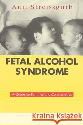 Fetal Alcohol Syndrome : A Guide for Families and Communities Ann P. Streissguth 9781557662835 Brookes Publishing Company - książka