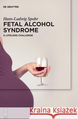 Fetal Alcohol Syndrome: A Lifelong Challenge Spohr, Hans-Ludwig 9783110442076 de Gruyter - książka