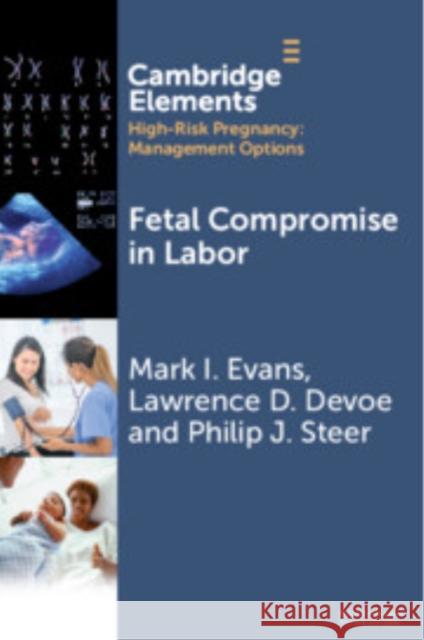 Fetal Compromise in Labor Philip J. (Imperial College London) Steer 9781009466301 Cambridge University Press - książka