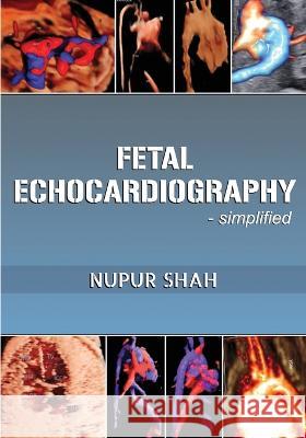 Fetal Echocardiography - Simplified Nupur Shah 9781636408484 White Falcon Publishing - książka