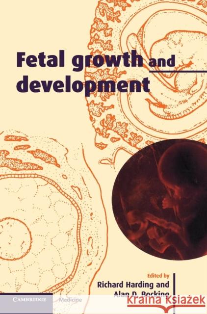 Fetal Growth and Development Alan D. Bocking Richard Harding 9780521642378 Cambridge University Press - książka