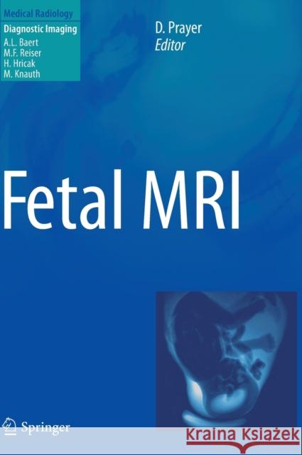 Fetal MRI Daniela Prayer 9783540732709 Springer - książka