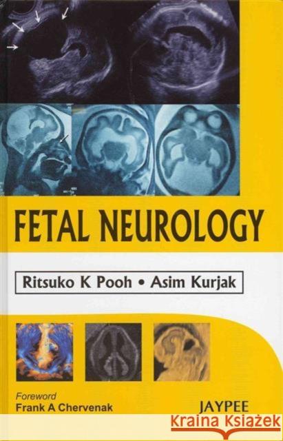 Fetal Neurology  9788184486926 Jaypee Brothers Medical Publishers - książka