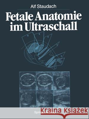 Fetale Anatomie Im Ultraschall Staudach, Alf 9783662007921 Springer - książka