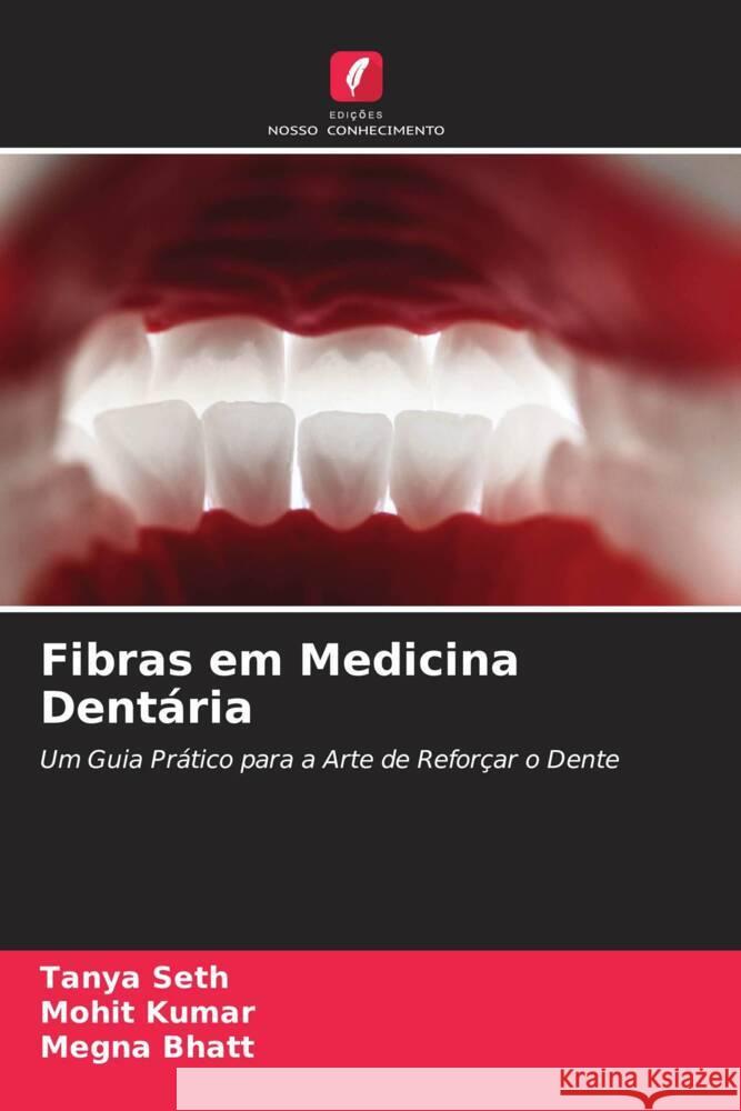 Fibras em Medicina Dent?ria Tanya Seth Mohit Kumar Megna Bhatt 9786208126919 Edicoes Nosso Conhecimento - książka