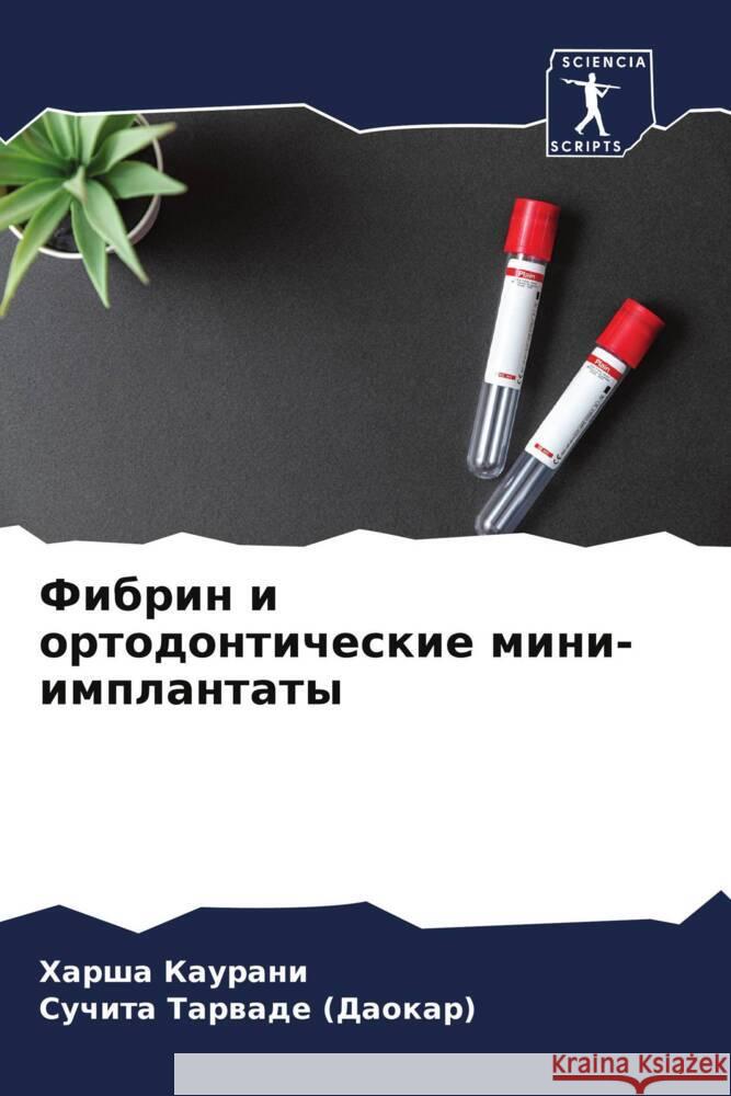 Fibrin i ortodonticheskie mini-implantaty Kaurani, Harsha, Tarwade (Daokar), Suchita 9786204688480 Sciencia Scripts - książka