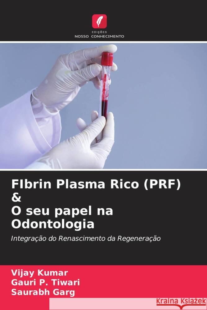 FIbrin Plasma Rico (PRF) & O seu papel na Odontologia Kumar, Vijay, Tiwari, Gauri P., Garg, Saurabh 9786204698700 Edições Nosso Conhecimento - książka