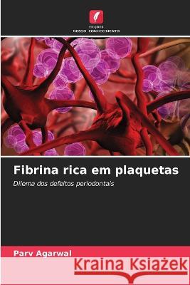 Fibrina rica em plaquetas Parv Agarwal   9786206081012 Edicoes Nosso Conhecimento - książka