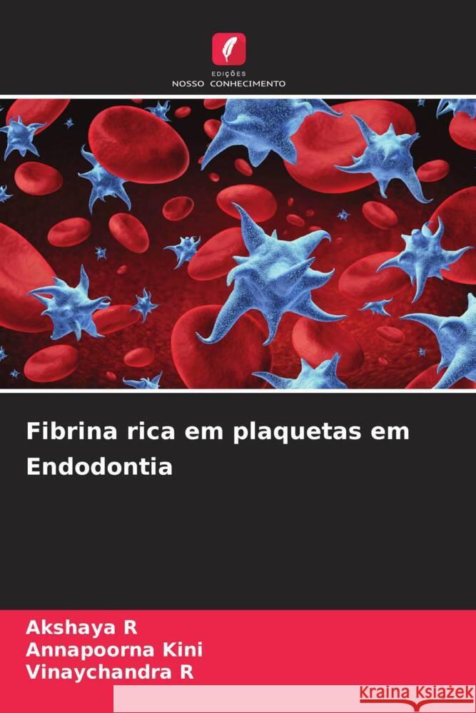 Fibrina rica em plaquetas em Endodontia R, Akshaya, Kini, Annapoorna, R, Vinaychandra 9786208361204 Edições Nosso Conhecimento - książka