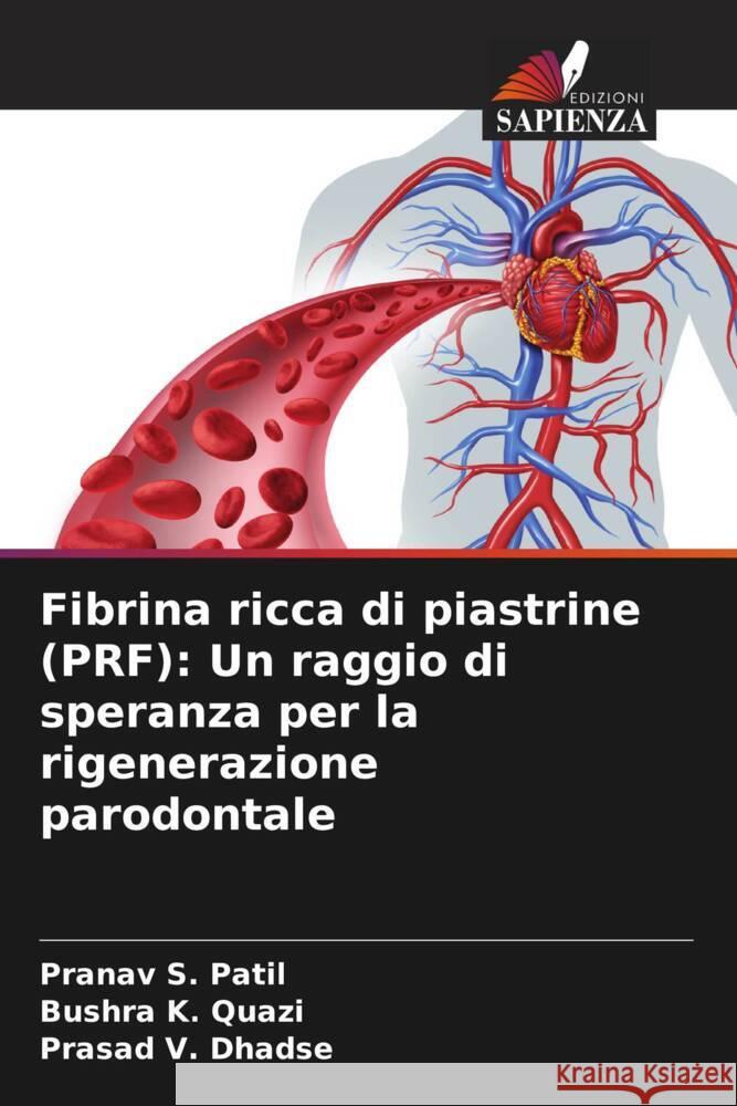 Fibrina ricca di piastrine (PRF): Un raggio di speranza per la rigenerazione parodontale Pranav S. Patil Bushra K Prasad V. Dhadse 9786207373307 Edizioni Sapienza - książka