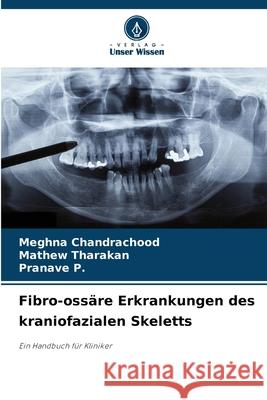 Fibro-ossäre Erkrankungen des kraniofazialen Skeletts Chandrachood, Meghna, Tharakan, Mathew, P., Pranave 9786209113079 Verlag Unser Wissen - książka