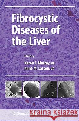 Fibrocystic Diseases of the Liver Karen Field Murray Anne M. Larson 9781603275231 Humana Press - książka