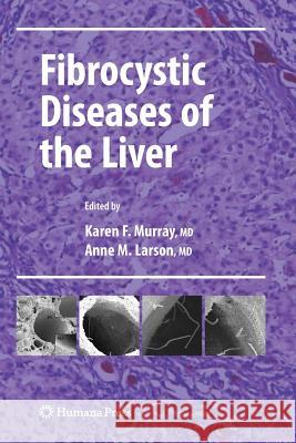 Fibrocystic Diseases of the Liver Karen F. Murray Anne M. Larson 9781617796852 Humana Press - książka