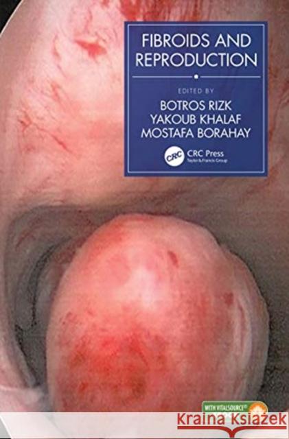 Fibroids and Reproduction Botros Rizk Yakoub Khalaf Mostafa Borahay 9781138305427 CRC Press - książka