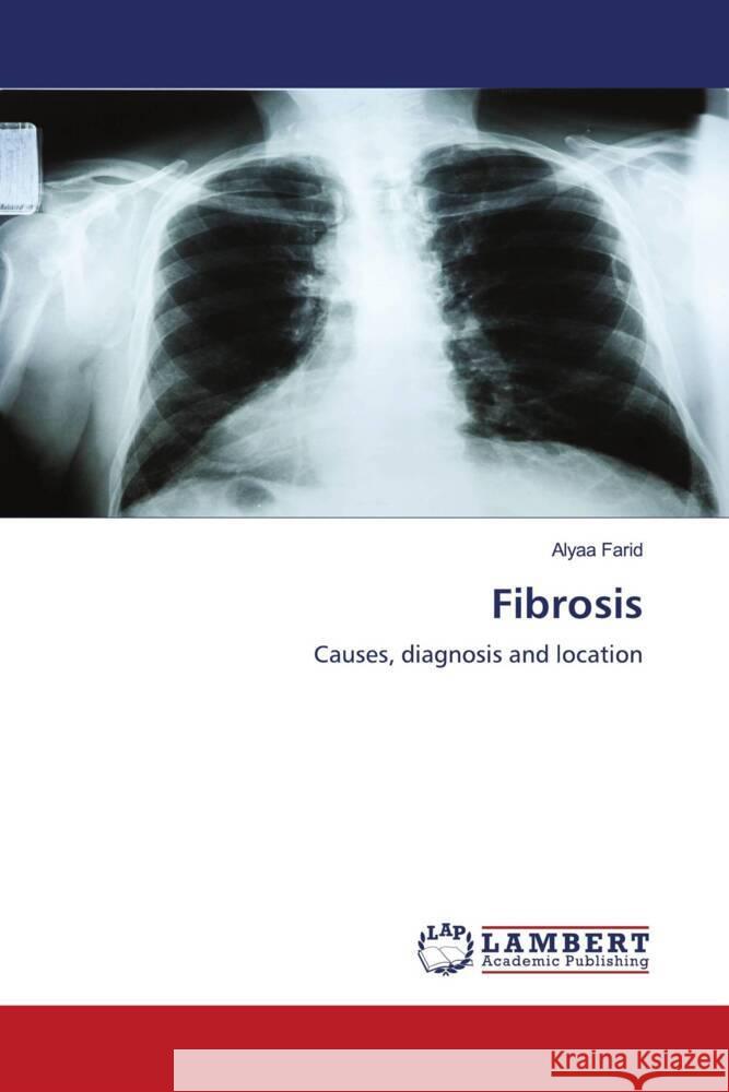 Fibrosis Farid, Alyaa 9786202922142 LAP Lambert Academic Publishing - książka