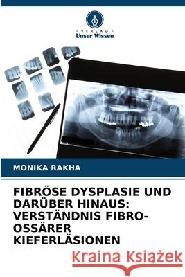FIBRÖSE DYSPLASIE UND DARÜBER HINAUS: VERSTÄNDNIS FIBRO-OSSÄRER KIEFERLÄSIONEN RAKHA, MONIKA 9786208727697 Verlag Unser Wissen - książka