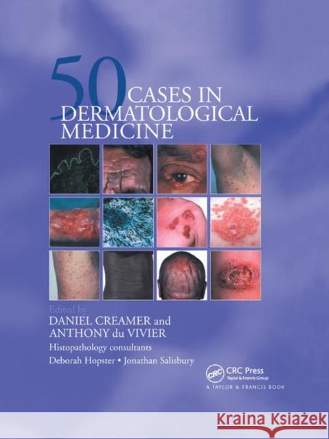 Fifty Dermatological Cases Daniel Creamer Anthony D 9780367393441 CRC Press - książka