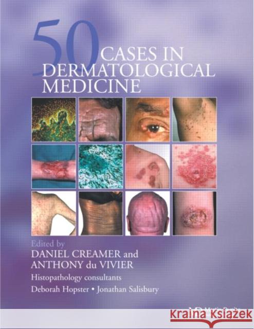 Fifty Dermatological Cases Duvivier                                 Creamers                                 Daniel Creamer 9781841841434 Taylor & Francis Group - książka