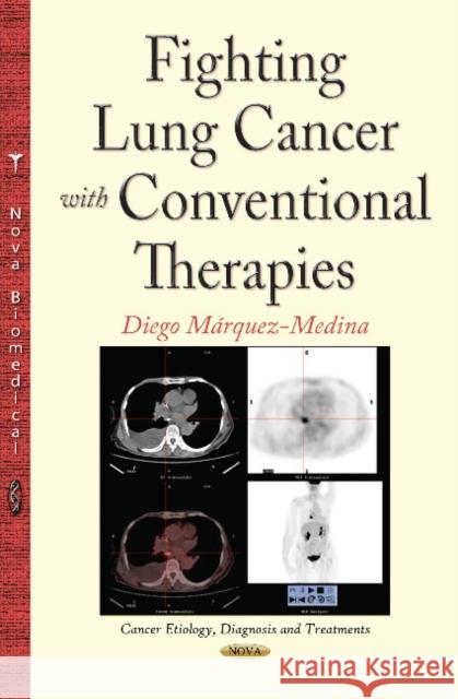 Fighting Lung Cancer with Conventional Therapies Dr Diego Márquez-Medina 9781634832755 Nova Science Publishers Inc - książka