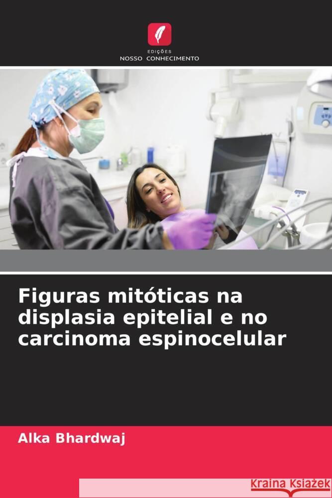 Figuras mitóticas na displasia epitelial e no carcinoma espinocelular Bhardwaj, Alka 9786208281021 Edições Nosso Conhecimento - książka