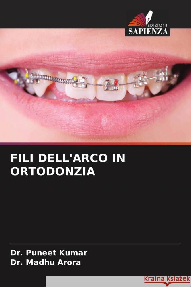 FILI DELL'ARCO IN ORTODONZIA Kumar, Dr. Puneet, Arora, Dr. Madhu 9786208248116 Edizioni Sapienza - książka