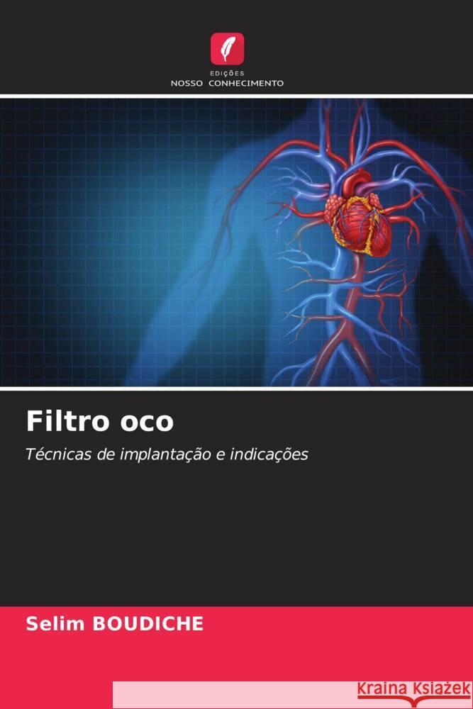 Filtro oco Boudiche, Selim 9786204392837 Edicoes Nosso Conhecimento - książka