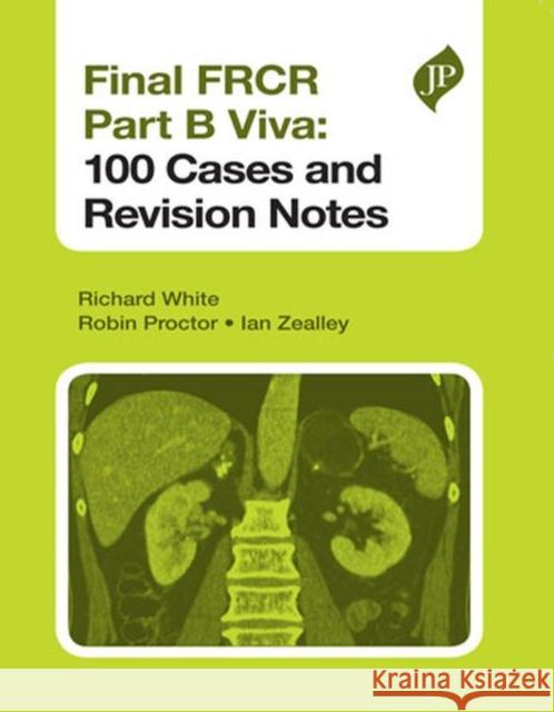 Final FRCR Part B Viva: 100 Cases and Revision Notes Richard White 9781907816482 Jp Medical Ltd - książka