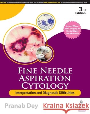 Fine Needle Aspiration Cytology: Interpretation and Diagnostic Difficulties Pranab Dey 9789356969667 Jaypee Brothers Medical Publishers - książka