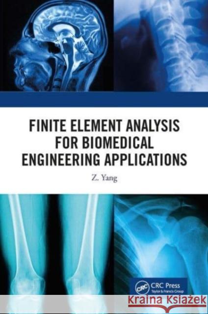 Finite Element Analysis for Biomedical Engineering Applications Z. Yang 9781032653914 CRC Press - książka