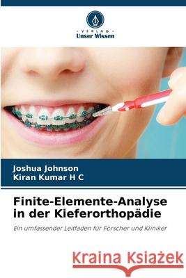 Finite-Elemente-Analyse in der Kieferorthopädie Johnson, Joshua, Kumar H C, Kiran 9786200690685 Verlag Unser Wissen - książka