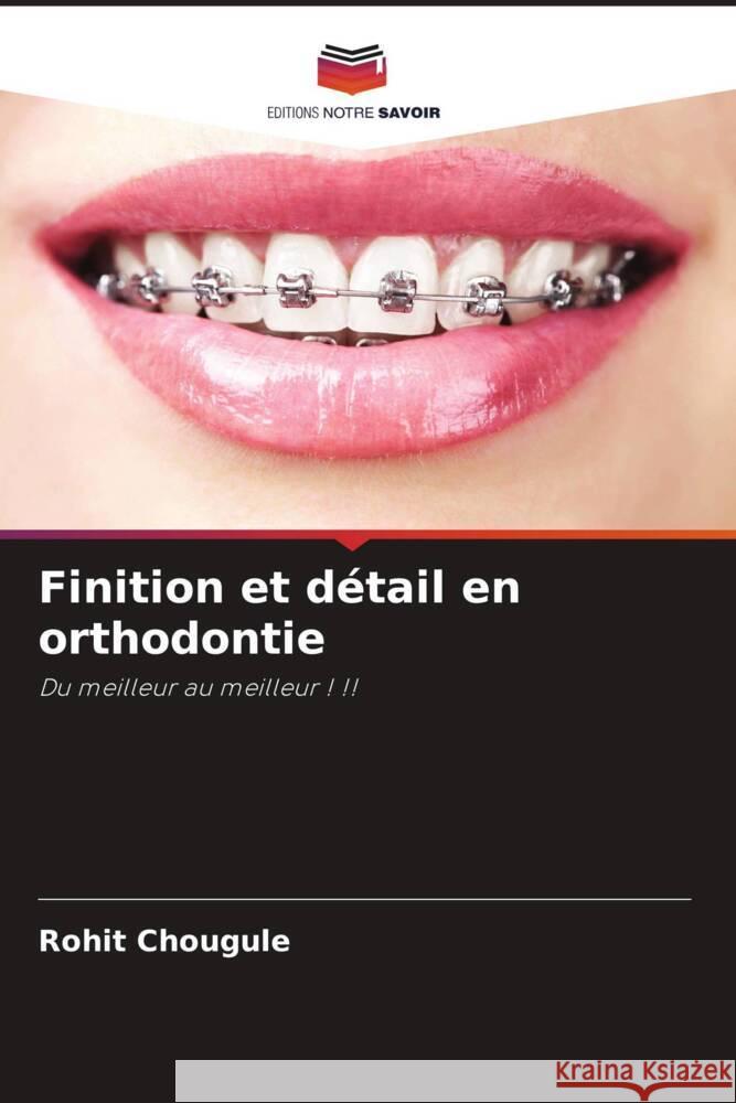 Finition et détail en orthodontie Chougule, Rohit 9786205037997 Editions Notre Savoir - książka