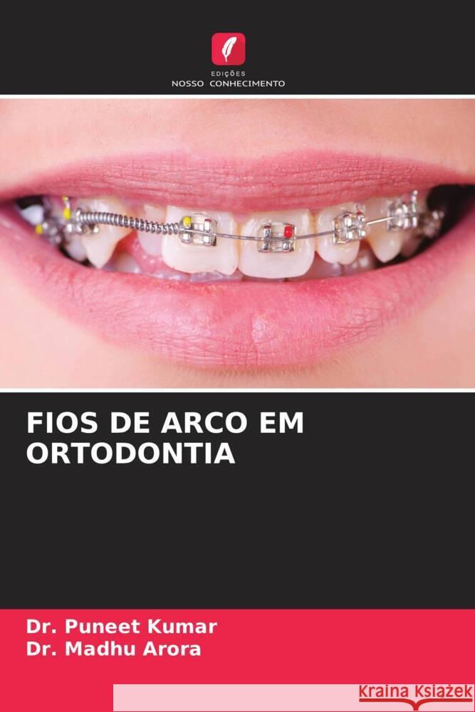 FIOS DE ARCO EM ORTODONTIA Kumar, Dr. Puneet, Arora, Dr. Madhu 9786208248147 Edições Nosso Conhecimento - książka