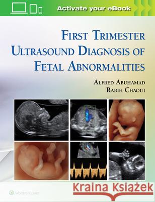 First Trimester Ultrasound Diagnosis of Fetal Abnormalities Alfred Z. Abuhamad 9781451193725 Lippincott Williams and Wilkins - książka