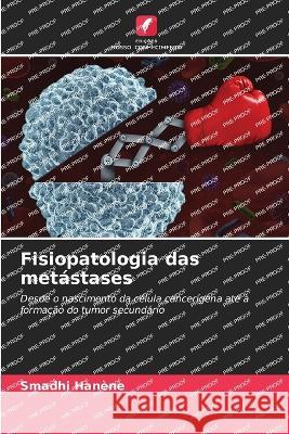 Fisiopatologia das metastases Smadhi Hanene   9786205890158 Edicoes Nosso Conhecimento - książka