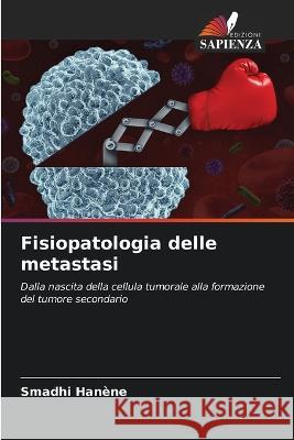 Fisiopatologia delle metastasi Smadhi Hanene   9786205890141 Edizioni Sapienza - książka