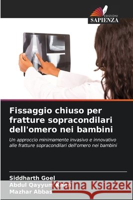 Fissaggio chiuso per fratture sopracondilari dell'omero nei bambini Goel, Siddharth, Khan, Abdul Qayyum, Abbas, Mazhar 9786209395208 Edizioni Sapienza - książka
