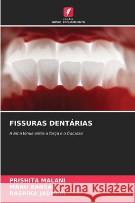 FISSURAS DENTÁRIAS MALANI, PRISHITA, Bansal, Manu, JAUHARI, RASHIKA 9786209094118 Edições Nosso Conhecimento - książka